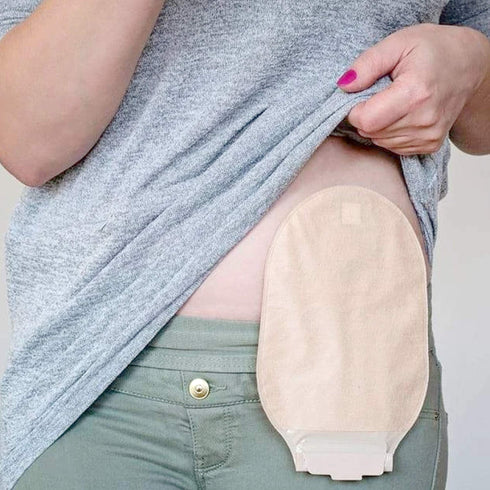 JJ CARE Ostomy Barrier Strips Pack of 20-5.62” Elastic Barrier Strips for Colostomy Bags, Latex-Free Skin Barrier Strips, Hydrocolloid Skin Barrier Strips for Stoma Bags, Waterproof & Moldable